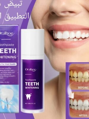 Blancheur Dentaire Premium – Gel de Blanchiment des Dents (30ml)